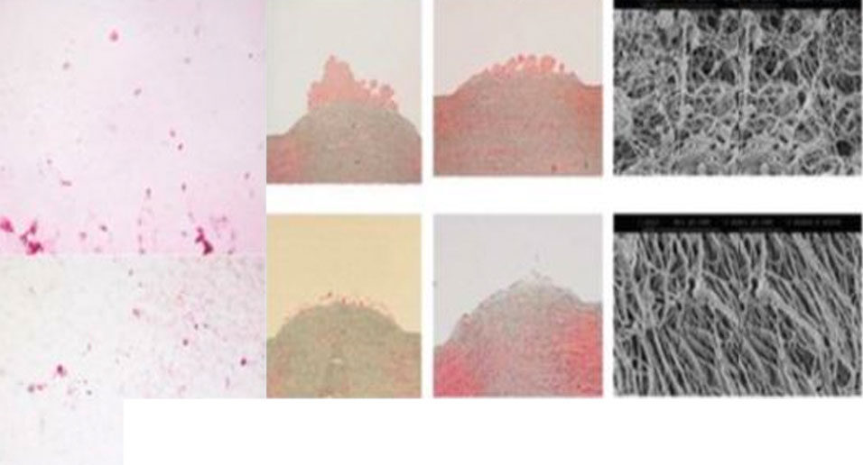 casestudy_img_novel_polymeric_heart