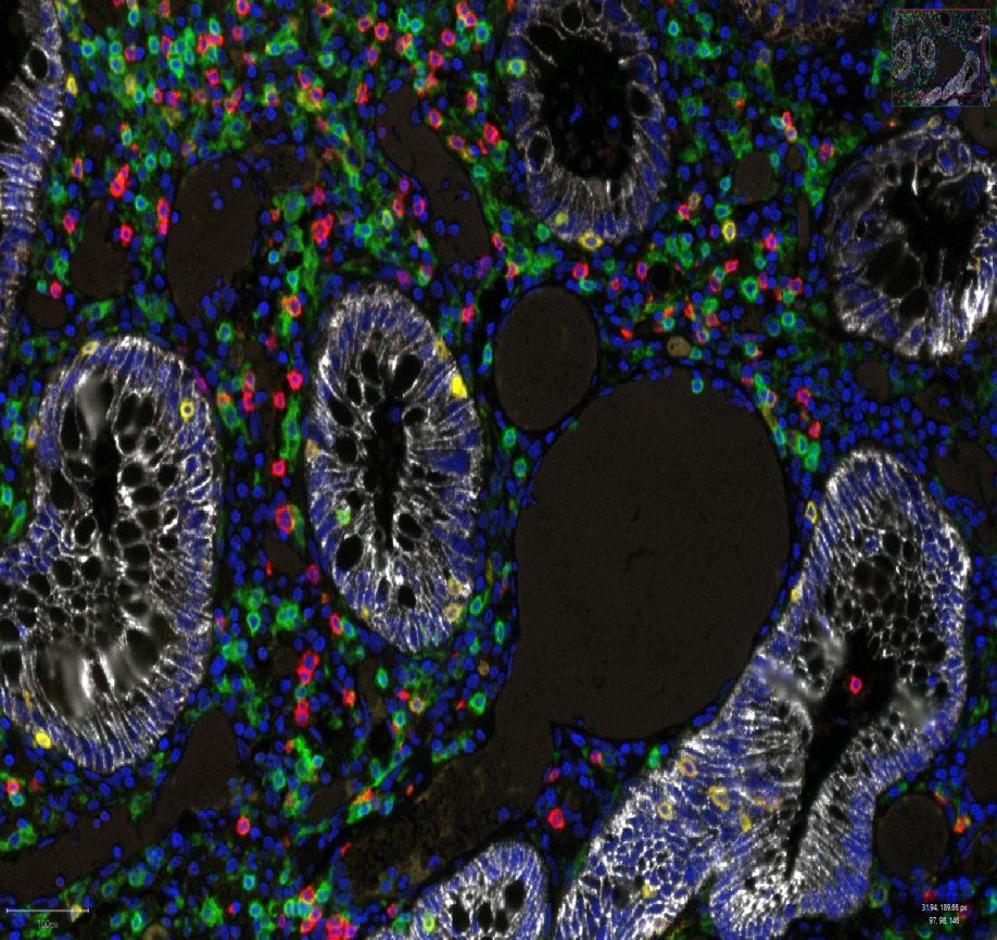 Multispectral imaging