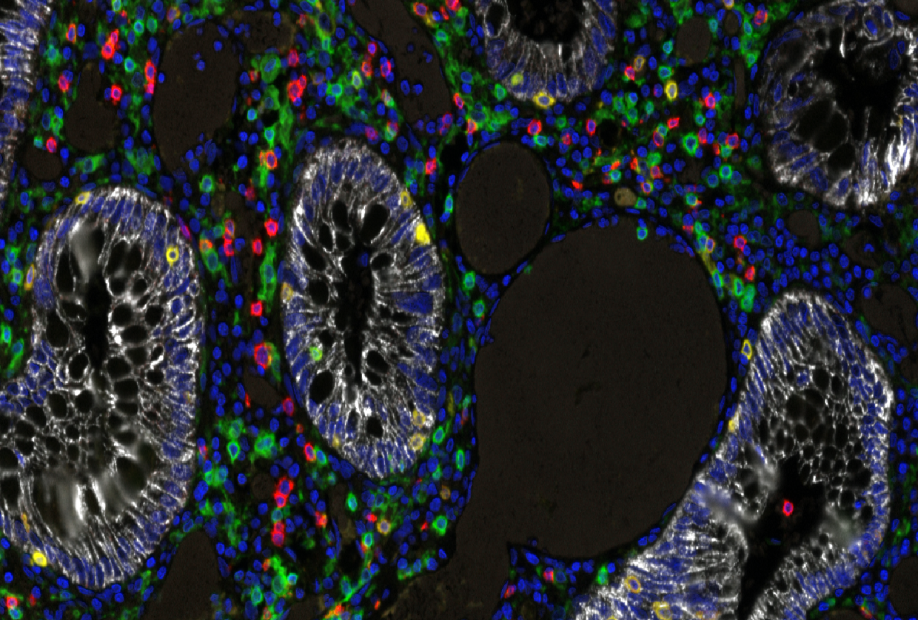 Multispectral imaging